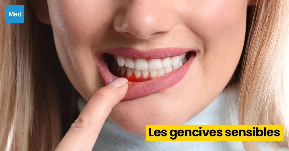 Les gencives sensibles : comprendre et soulager ce problème courant